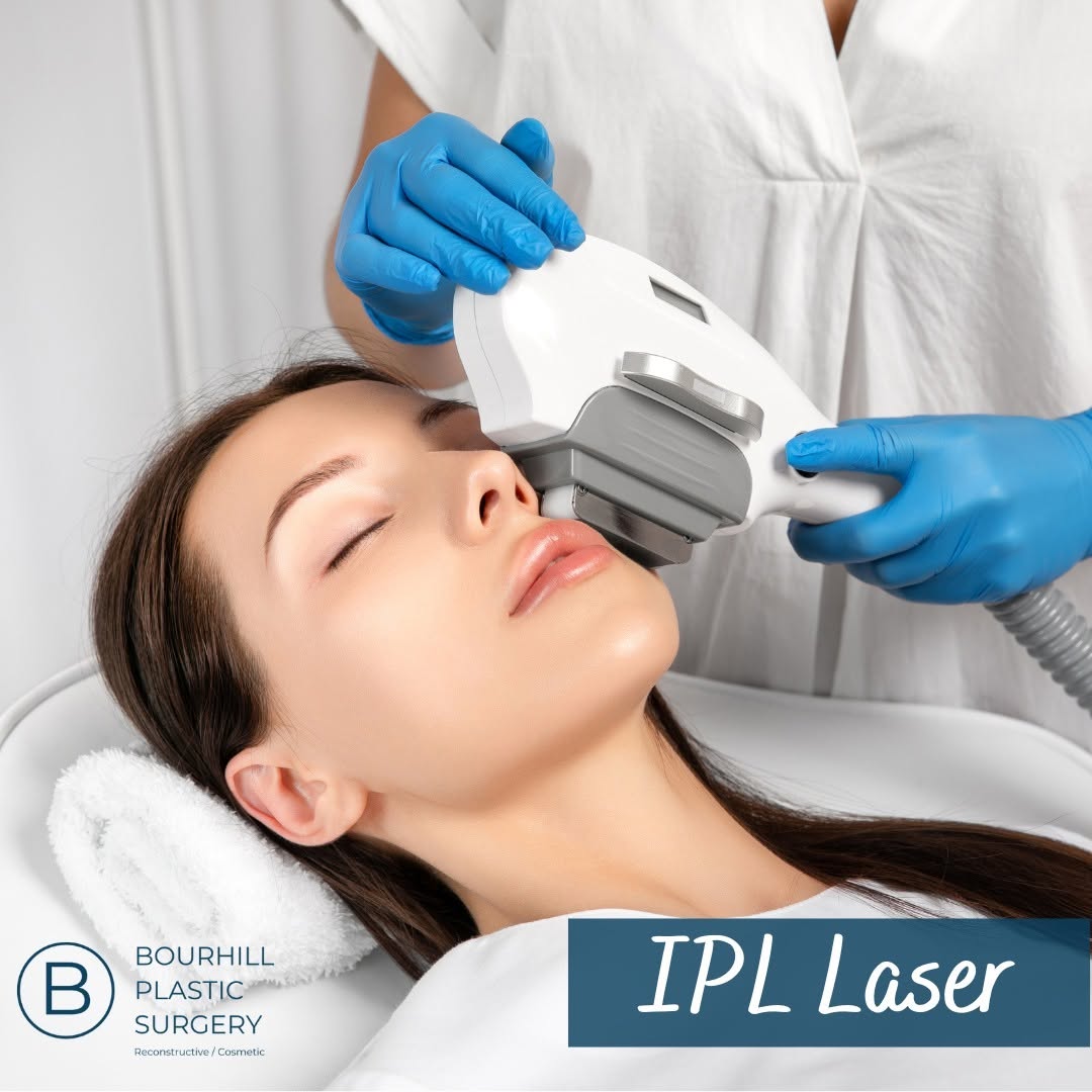Instagram post by Dr. Ian L. Bourhill: ✨ Discover the benefits of IPL Laser at Bourhill Plastic Surgery! ✨ Intense Pulsed Light (IPL) laser treatment offers numerous benefits for …