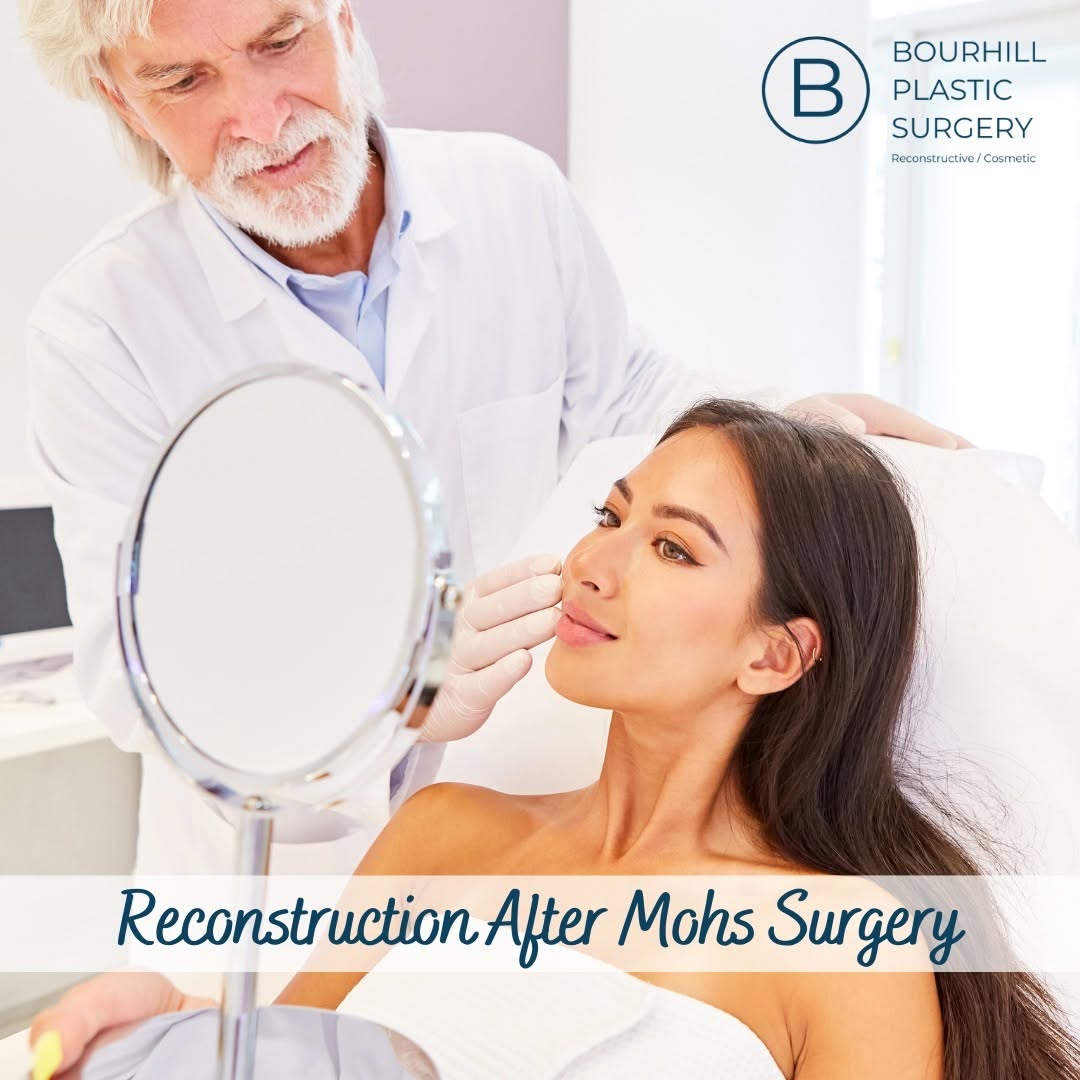 Instagram post by Dr. Ian L. Bourhill: At Bourhill Plastic Surgery, we provide expert reconstructive care following Mohs surgery to restore both form and function. Our experienced…