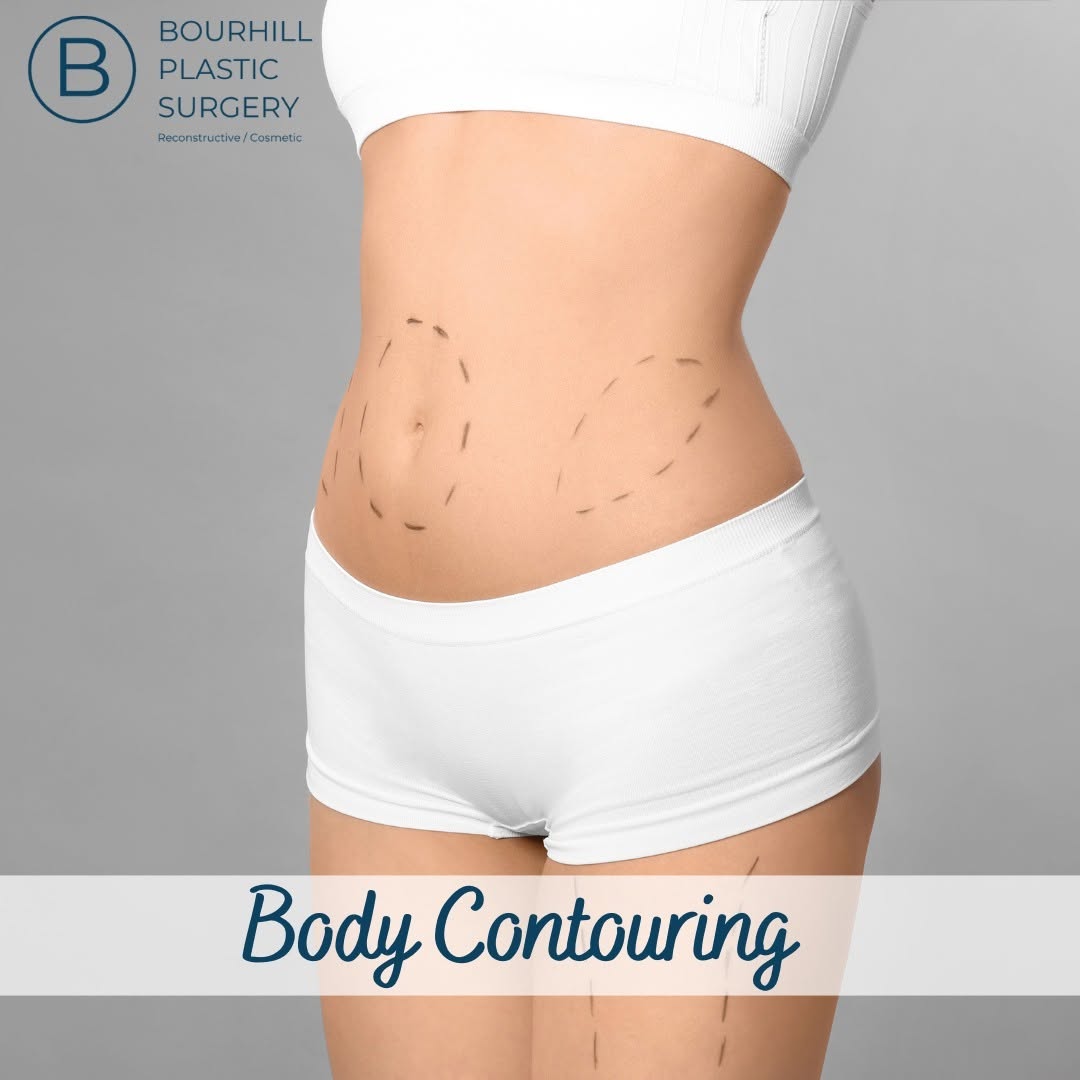 Instagram post by Dr. Ian L. Bourhill: Losing weight is a remarkable accomplishment, yet excess skin and stubborn fat can sometimes undermine your confidence. Our body contouring …