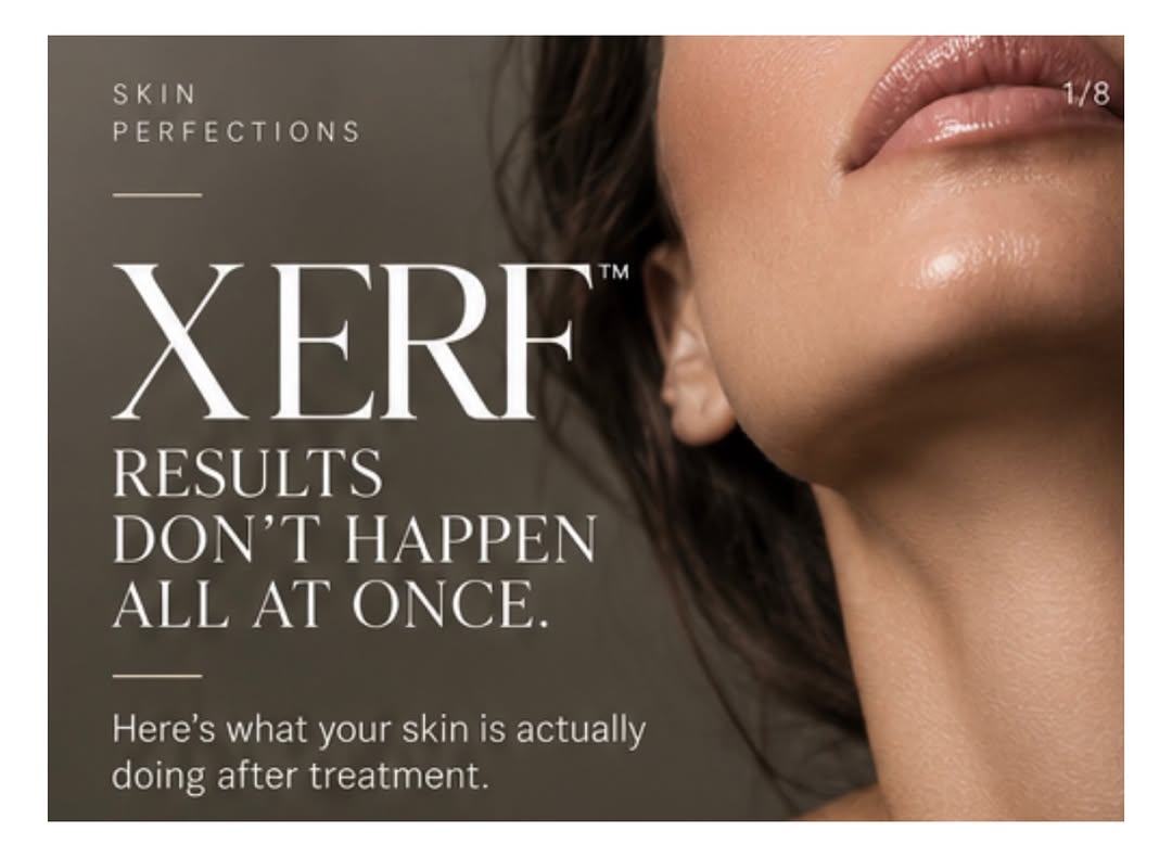 Instagram post by Dr. Irina Minina: WHY IS EVERYONE TALKING ABOUT XERF™? ✨ There’s a LOT of hype around XERF right now — and yes, it’s become a celebrity favorite. But what mak…