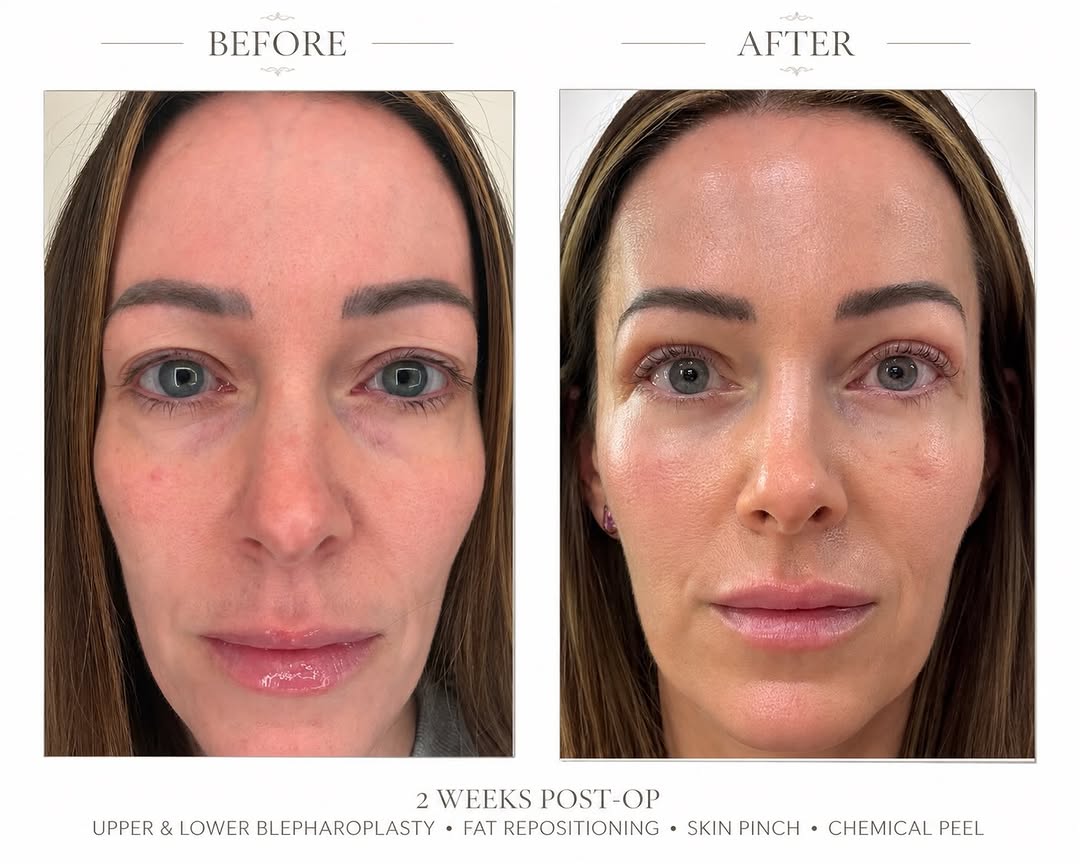 Instagram post by Dr. Ivan Vrcek: ✨ Sometimes the best treatment isn’t another syringe or a few more units of Botox. While we love what Botox, laser treatments, RF microneedl…
