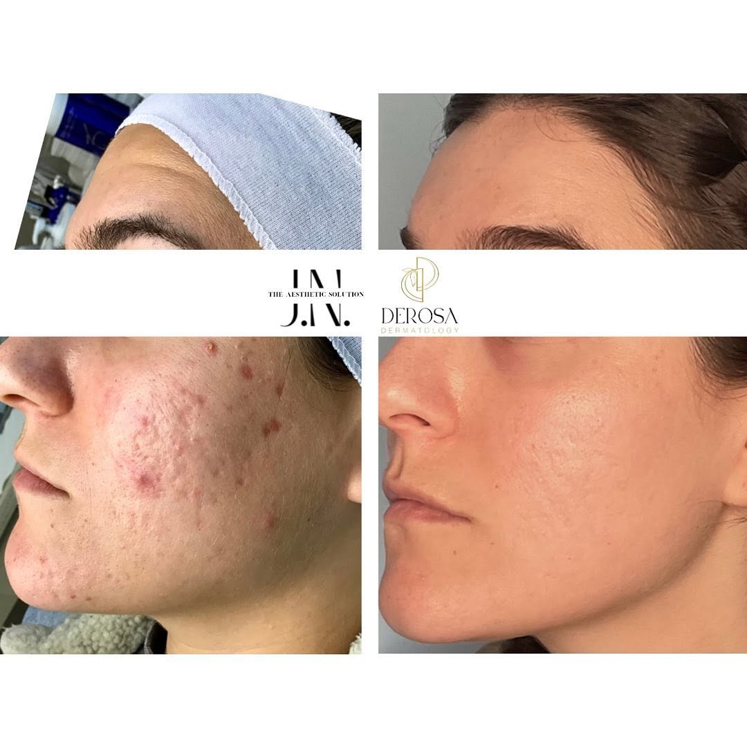 Instagram post by Dr. Ivy DeRosa, DO: We were both emotional reviewing these before and afters together last week admiring how far this beautiful person has come in her journey. …