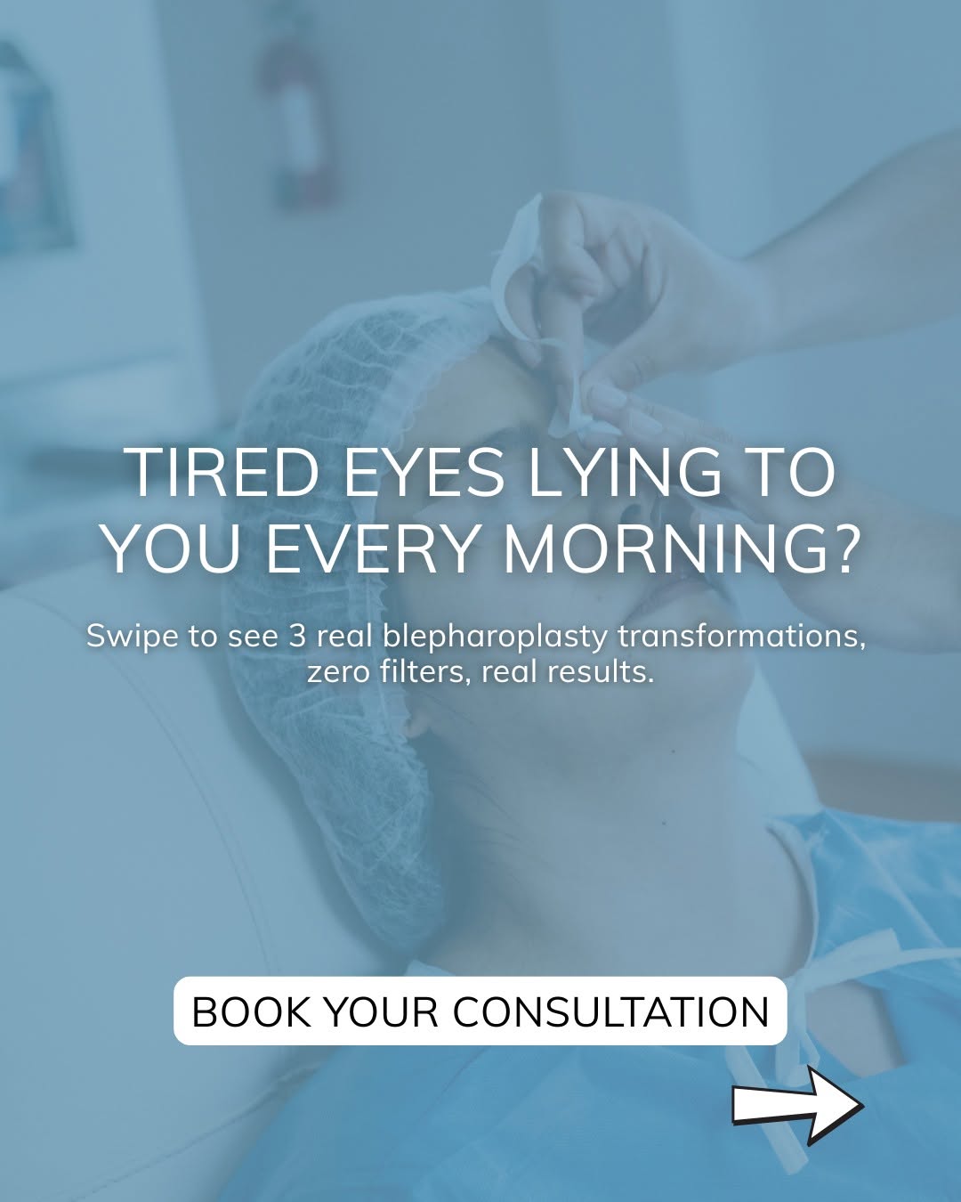 Instagram post by Dr. J. Phillip Garcia: Blepharoplasty before and after results show how eyelid surgery can create a brighter, more refreshed appearance while keeping the eyes look…