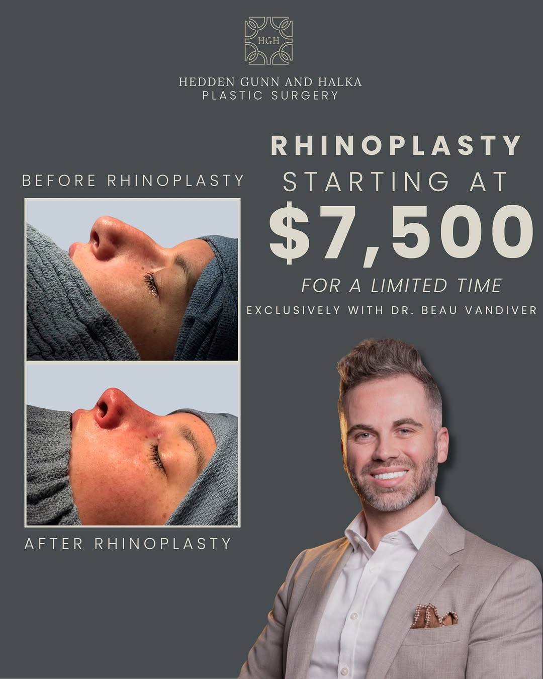Instagram post by Dr. J. Stephen Gunn: Rhinoplasty, exclusively with Dr. Beau Vandiver. ✨ For a limited time, rhinoplasty starting at $7,500 exclusively with Dr. Vandiver. Whether…