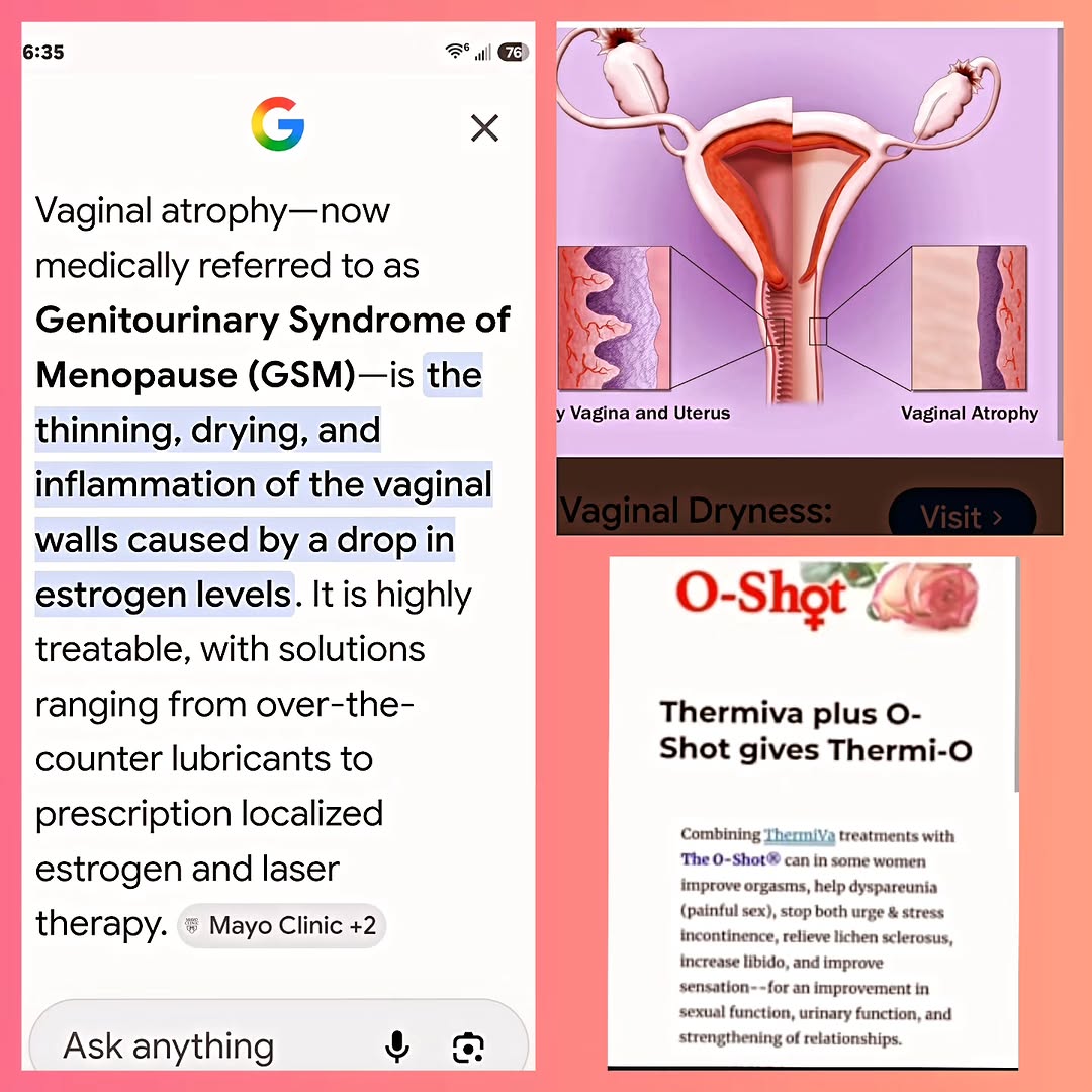 Instagram post by Dr. Jack G. Bertolino: Don't suffer with vaginal atrophy. We have answers and treatments to improve your vaginal health and sexual wellness. www.smoothsolutionsmed…