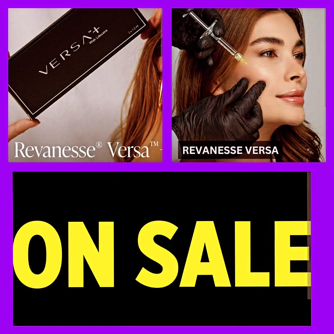 Instagram post by Dr. Jack G. Bertolino: On sale through September 30th. Versa filler, great for lip volume and mid face cheekbones. Buy 1 get $100 off $250 off. Must use same day, …