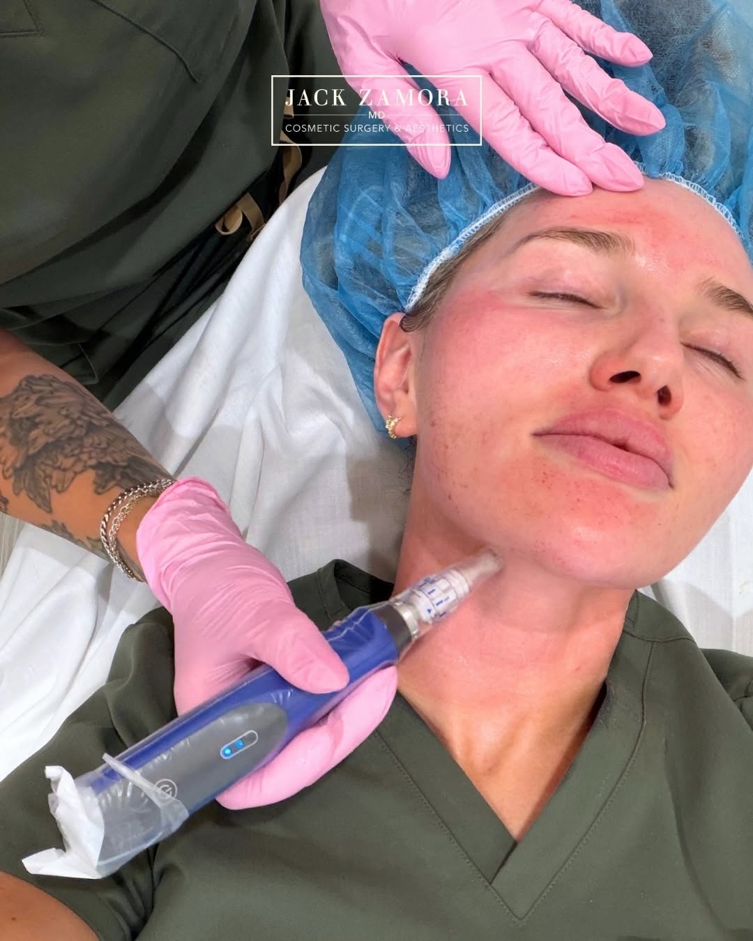 Instagram post by Dr. Jack Zamora: Summer has a way of showing up on your skin - and we’re not just talking about that glowy tan. We’re talking sun damage, dullness, and dehyd…