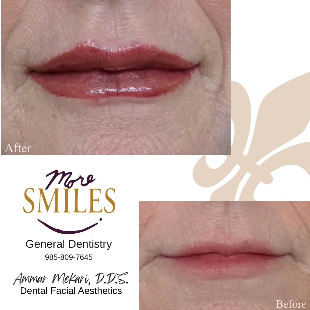 Instagram post by Dr. James A. Moreau, Jr., DDS