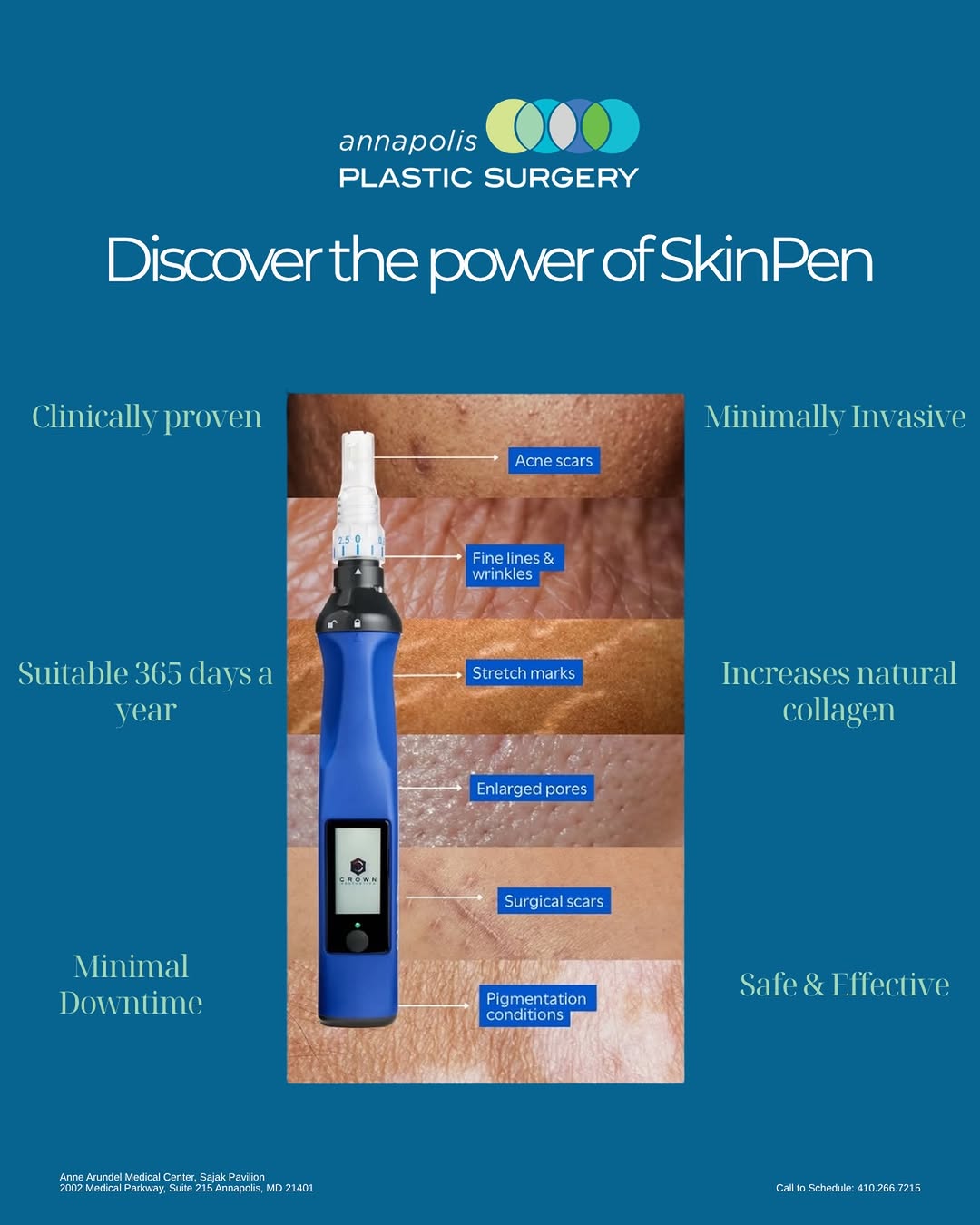 Instagram post by Dr. James E. Chappell: Great skin is always in season. ✨ #SkinPen microneedling is designed to improve the appearance of acne scars, stretch marks, surgical scars,…