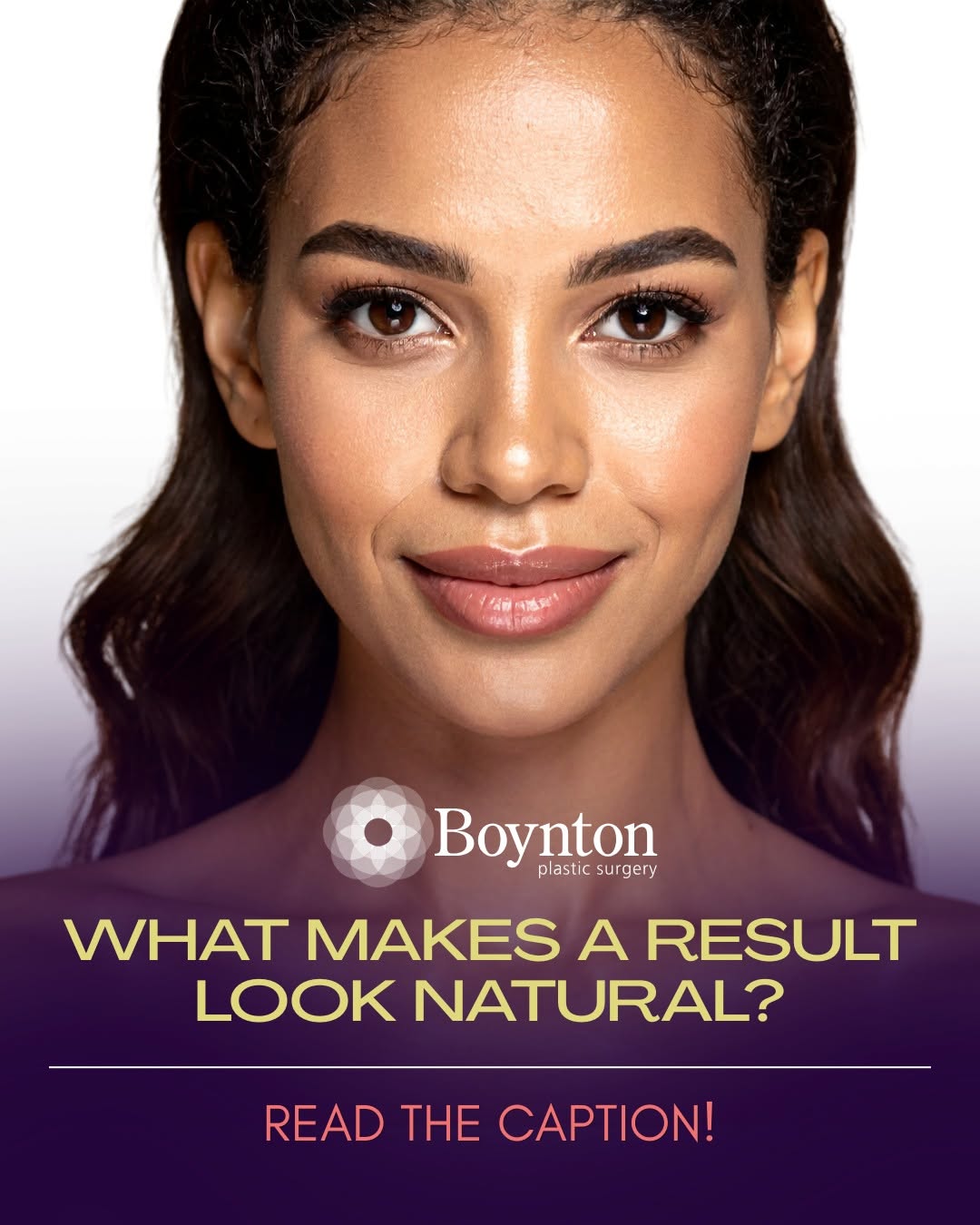 Instagram post by Dr. James F. Boynton: "I want to look like myself—just a little more refreshed." That's exactly the goal. Natural-looking results aren't about changing who you ar…