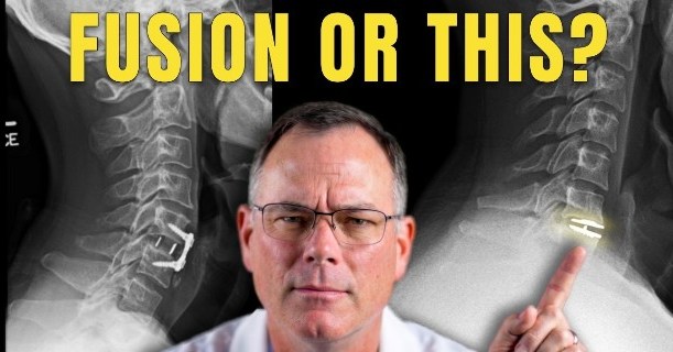 Instagram post by Dr. James M. Sheridan: Think neck fusion is your only surgical option? Think again. In the latest episode of The Surgeon Unmasked, Texas Orthopedics’ Dr. Randall S…