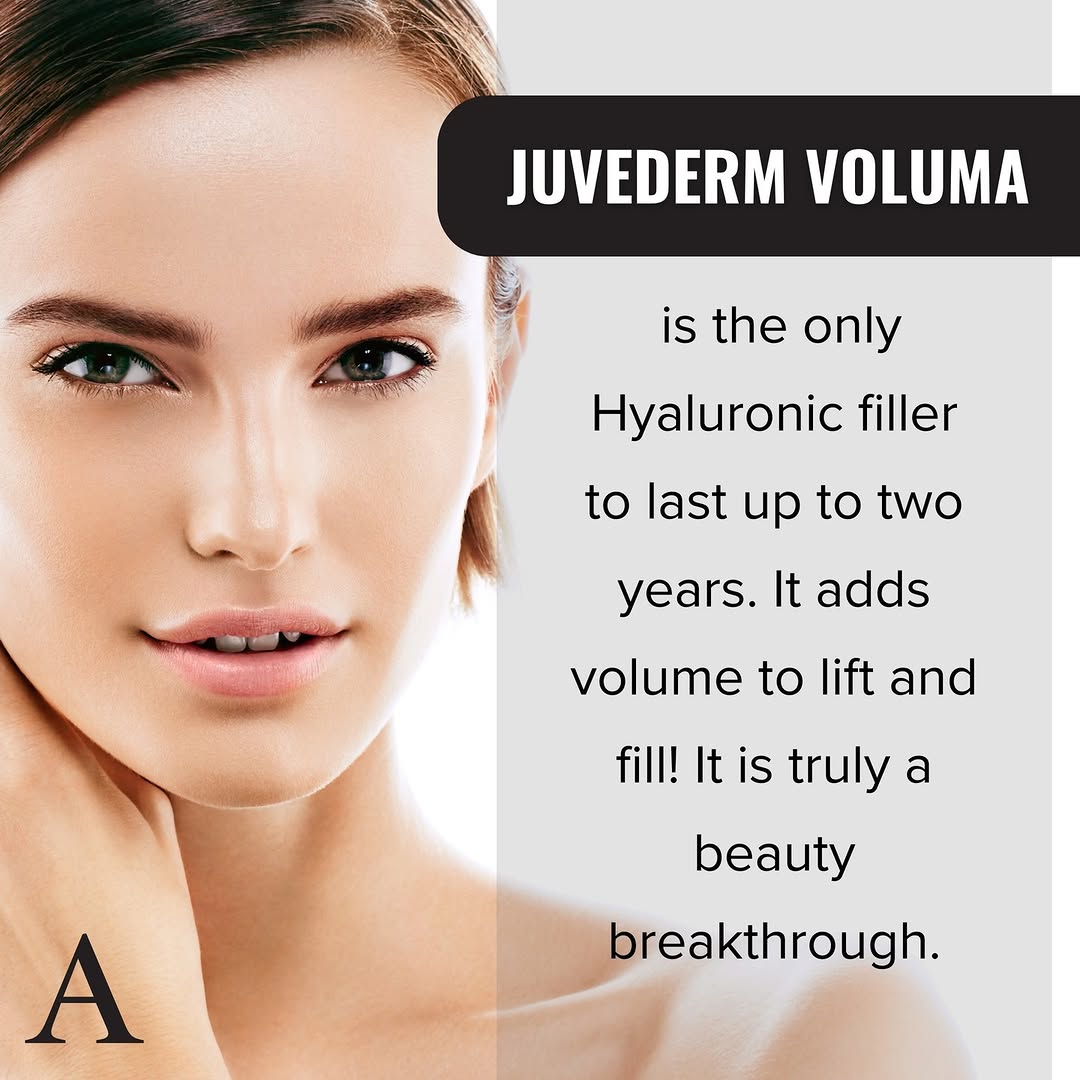 Instagram post by Dr. James McMahan: Juvederm Voluma is designed to restore lost volume in the hollows of the cheeks, which reduces the appearance of fine lines and wrinkles aro…