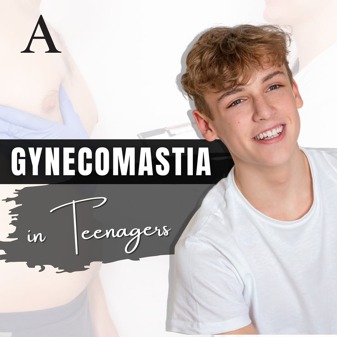Instagram post by Dr. James McMahan: Gynecomastia typically develops in young males around the time of puberty and generally only persists in a relatively small percentage of in…