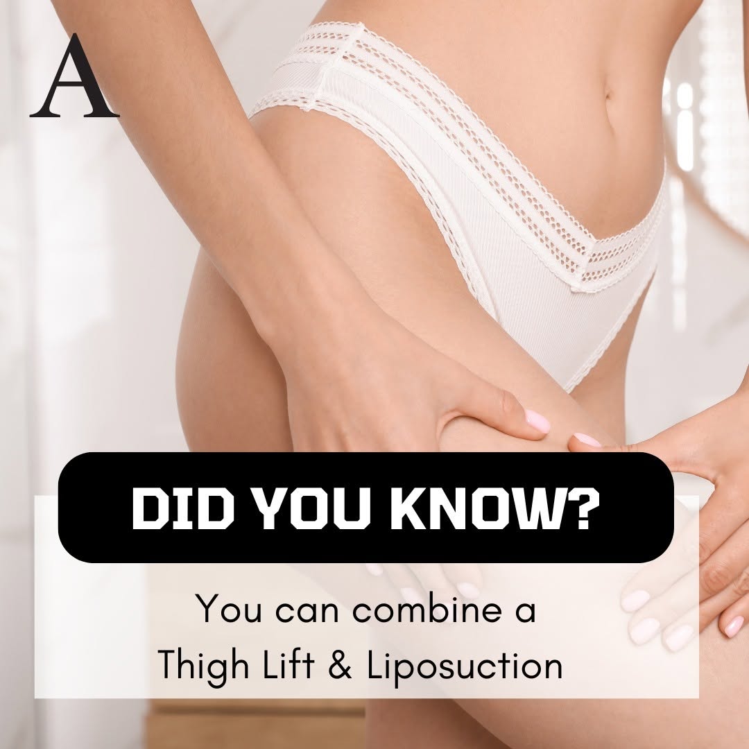 Instagram post by Dr. James McMahan: Thigh lift surgery, combined with liposuction, is an exceptional way to attain firmer, more contoured, and aesthetically pleasing upper legs…