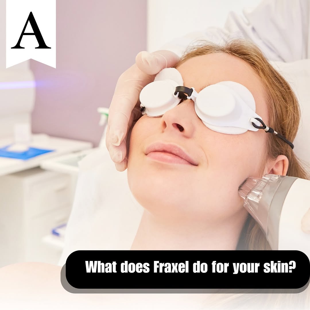 Instagram post by Dr. James McMahan: Fraxel is an incredibly effective skin rejuvenation treatment that utilizes state-of-the-art light energy technology to stimulate collagen a…