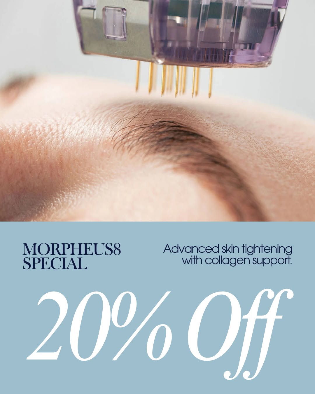 Instagram post by Dr. James Mirabile: Refresh Your Skin with Morpheus8 ✨ For a smoother, firmer, more youthful-looking complexion, experience the power of Morpheus8 — now 20% OFF…