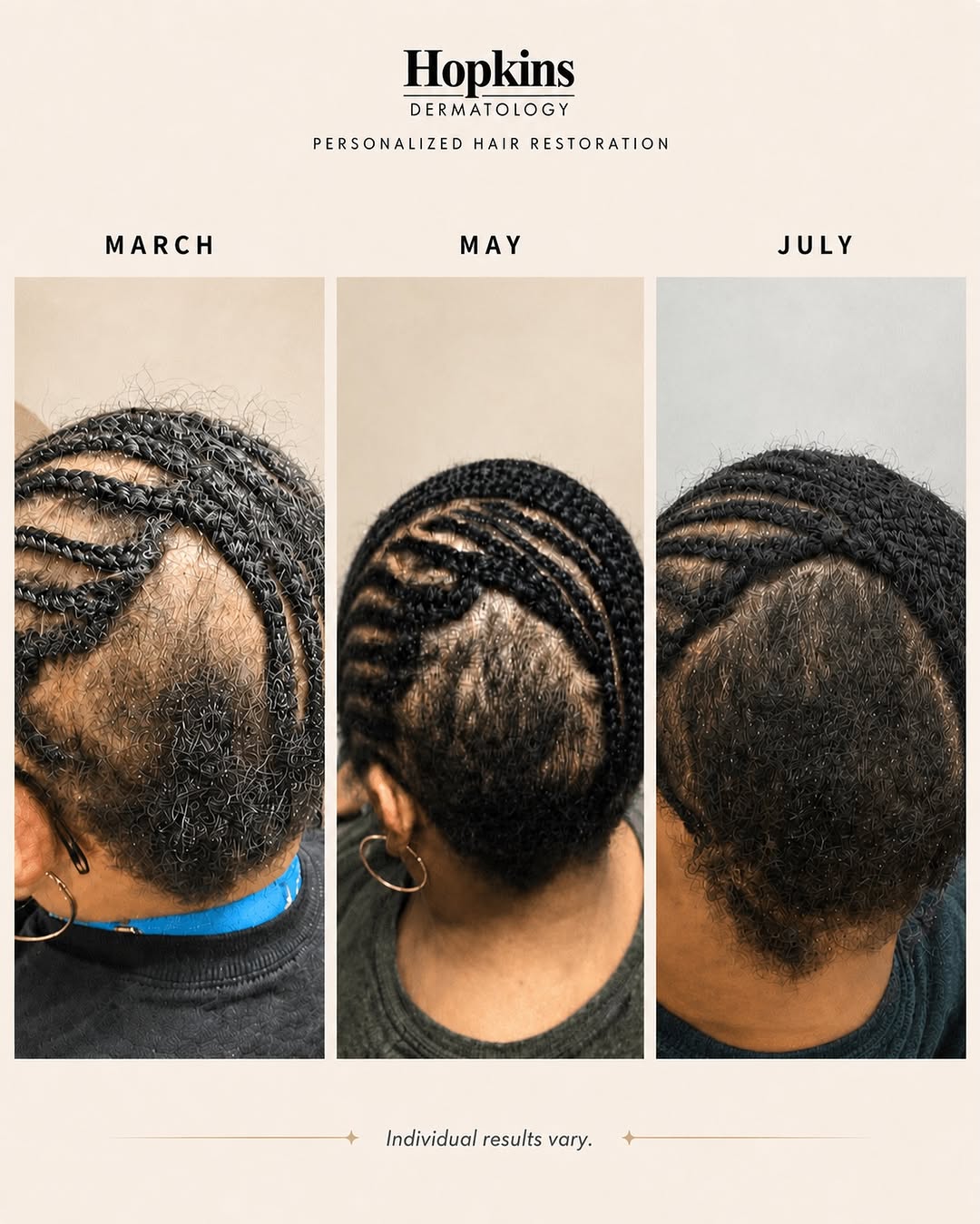 Instagram post by Dr. Janine Hopkins: Hair loss can affect more than your appearance—it may impact your confidence and well-being. If you’re noticing increased shedding, thinning…