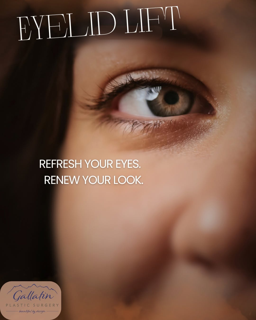 Instagram post by Dr. Jarred McDaniel: Ready for a change from droopy lids, dark circles and undereye bags? Find out how an eyelift can improve the contour of your eyes. Look more…