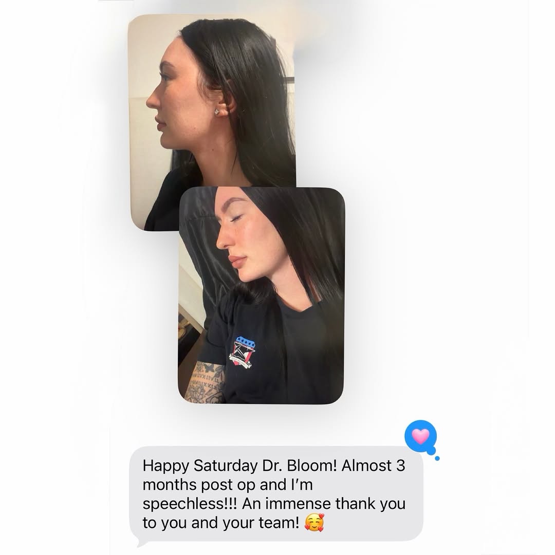 Instagram post by Dr. Jason D. Bloom: Selfie Saturday! 🤳🏻 📸 🔥 Do you remember this amazing patient who flew in from Arizona 3 months ago for her deep neck lift? Well, she sen…