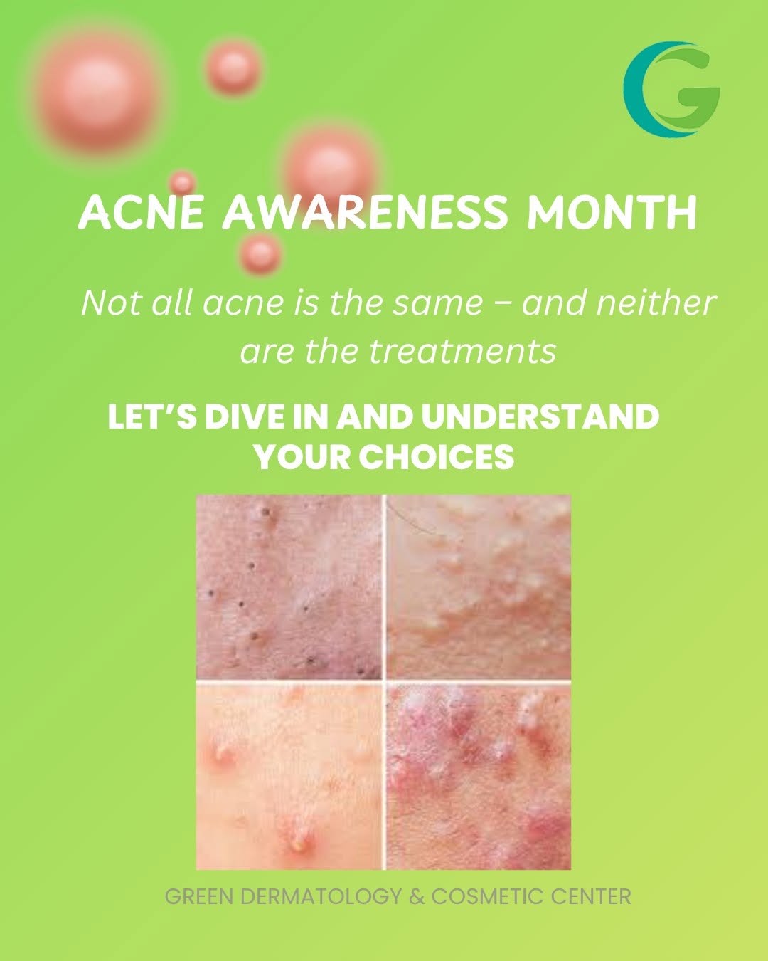 Instagram post by Dr. Jason Green: ✨ June is Acne Awareness Month ✨ Acne affects people of all ages and skin types. This month, we're committed to sharing education, breaking …