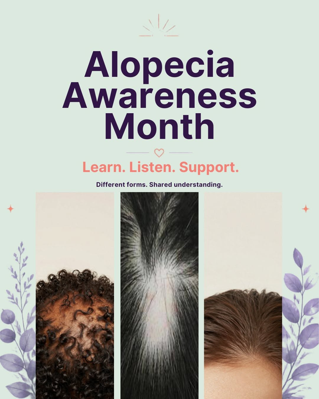 Instagram post by Dr. Jason Green: 💙 Alopecia Awareness Month 💙 Hair loss can change the way we see ourselves, but it never changes our worth. This month, we’re raising awar…