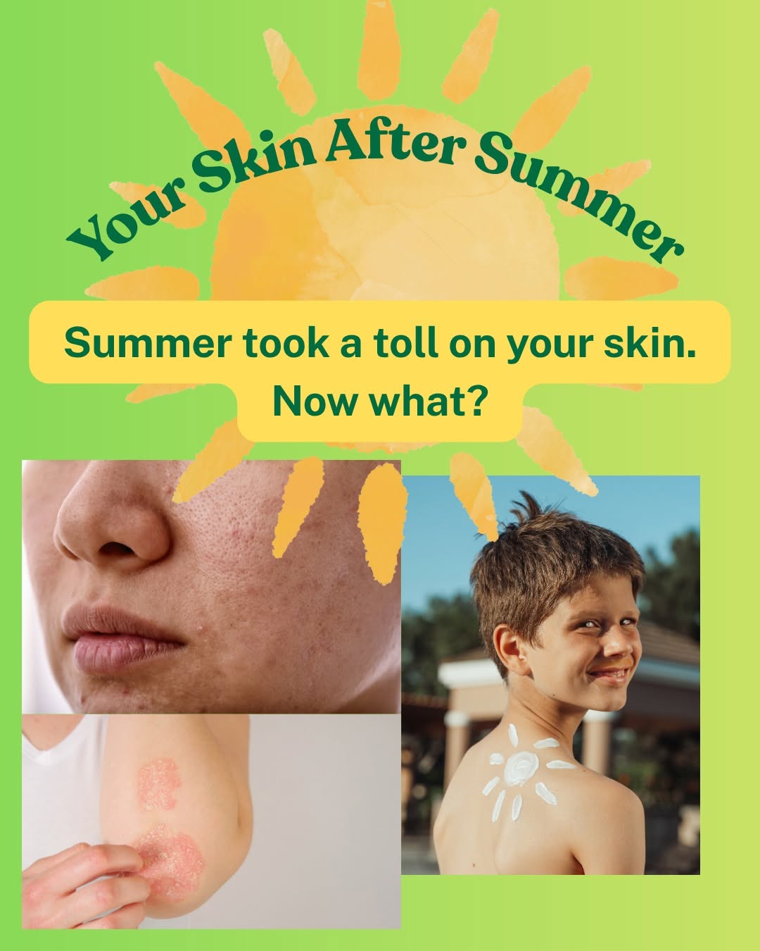 Instagram post by Dr. Jason Green: Summer took a toll on your skin. Now what? ☀️ After months of sun, heat, sweat, chlorine, and outdoor activities, your skin may be showing t…