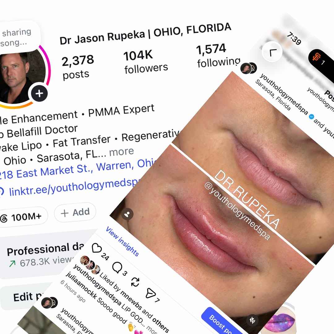 Instagram post by Dr. Jason Rupeka, DO: Ok, so... . . How do I have 104,000 organic followers and when I make a post (although nothing time stopping...) I get 24 likes?!? . . That …