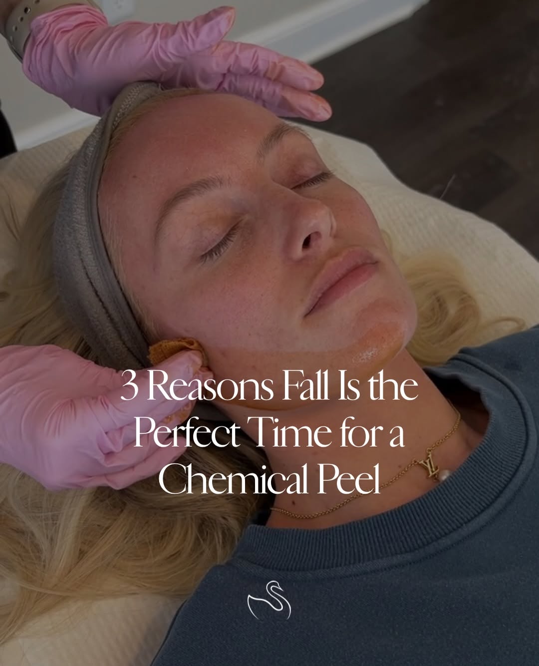 Instagram post by Dr. Jason Tomsic, DO: Fall is officially peel season. 🍂✨ If summer left your skin looking dull, uneven, or a little rough, fall is the perfect time to hit reset.…