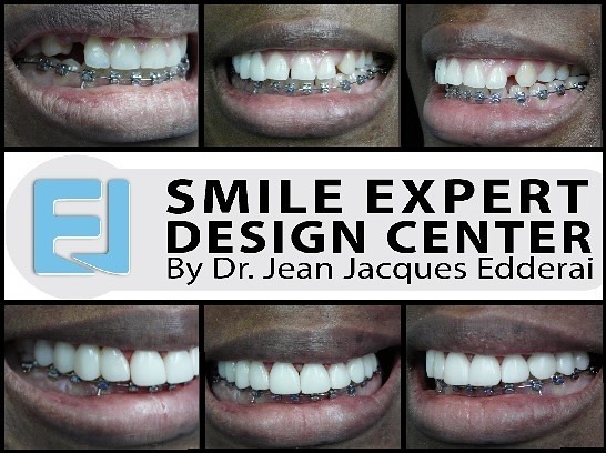 Instagram post by Dr. Jean-Jacques Edderai