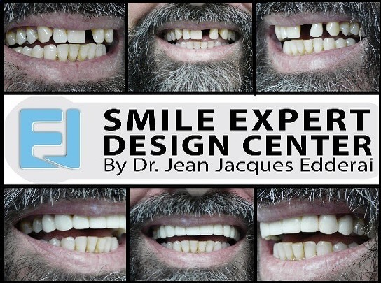 Instagram post by Dr. Jean-Jacques Edderai
