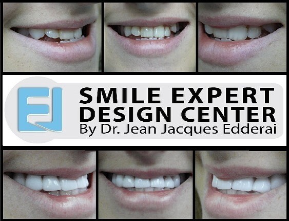 Instagram post by Dr. Jean-Jacques Edderai
