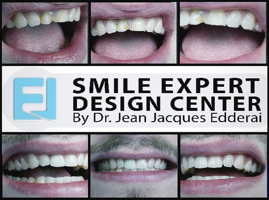 Instagram post by Dr. Jean-Jacques Edderai