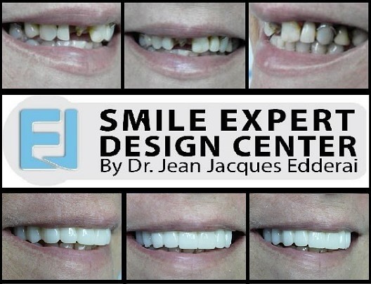 Instagram post by Dr. Jean-Jacques Edderai