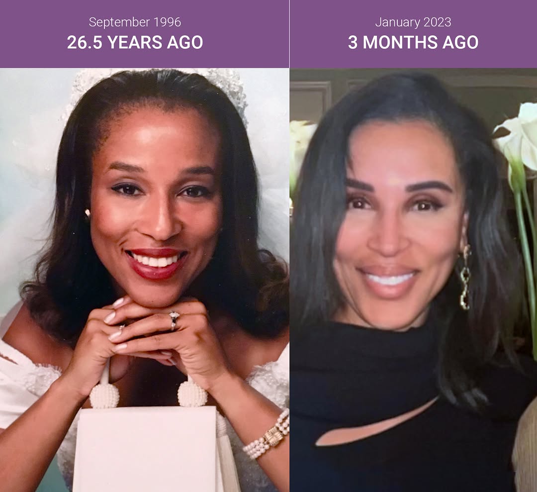 Instagram post by Dr. Jeanine B. Downie: Don't underestimate the power of taking care of your skin! Trust me, your future self will thank you for the time and care you put in today.…