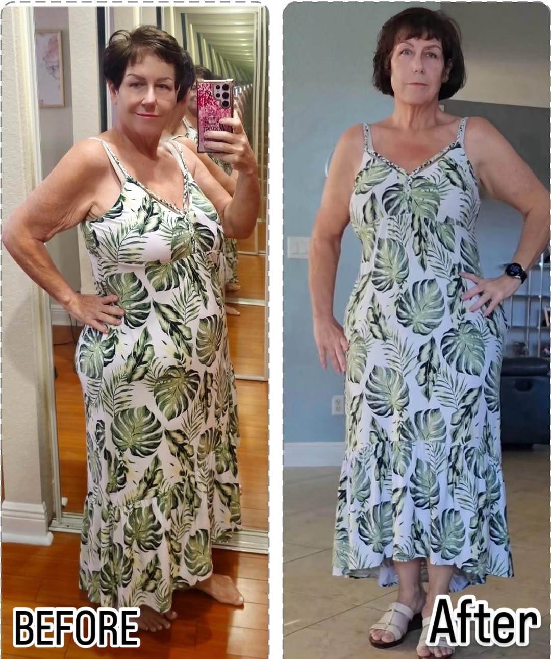 Instagram post by Dr. Jeffrey C. Hamm: 🤩Another happy patient of @dr.strax.hamm Our patient lost over 250 pounds and then came to @straxaesthetics for a one-day procedure, includ…