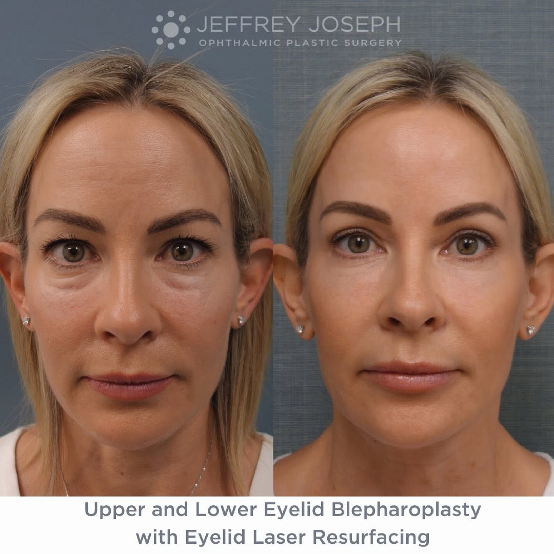 Instagram post by Dr. Jeffrey M. Joseph: When you “look tired” but you actually are feeling great and energized 🤷🏼♀️It can be frustrating to not have your outer appearance reflec…