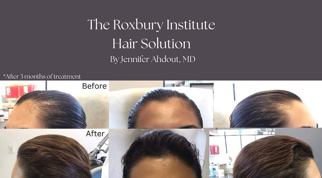 Instagram post by Dr. Jennifer Ahdout: What do you think? Our hair solution is better than yours! We have worked hard to formulate the optimal hair solution for hair growth. The r…
