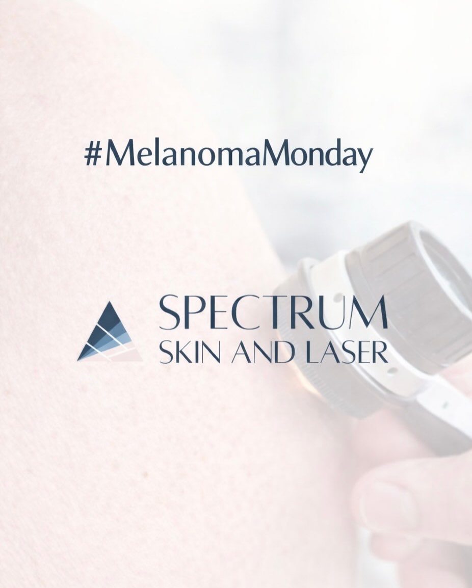 Instagram post by Dr. Jeremy A. Brauer: Yesterday was #MelanomaMonday! While May is #SkinCancerAwarenessMonth, it’s important to stay aware of the signs of melanoma year-round and …