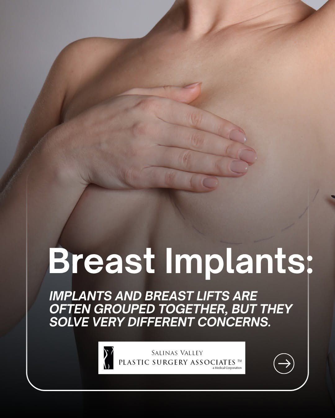 Instagram post by Dr. Jeremy Silk: Implants. Lift. Both. They’re often mentioned together, but they don’t do the same job. One builds volume and fullness...the other restores …