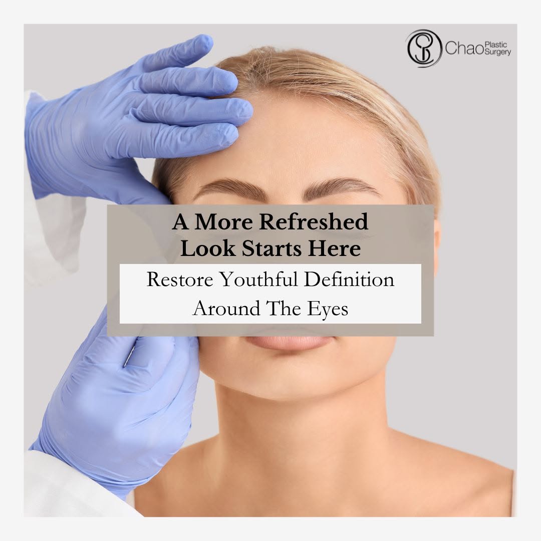 Instagram post by Dr. Jerome D. Chao: Do your eyes make you look more tired than you feel? Blepharoplasty, or eyelid lift surgery, can address excess skin and tissue on the upper…