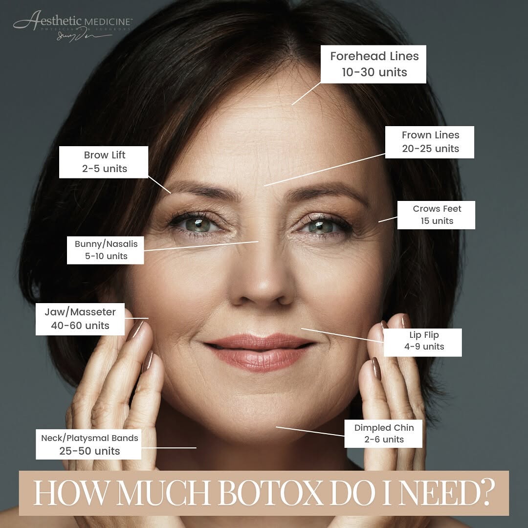 Instagram post by Dr. Jerry Darm: So, how much Botox do you really need? Everyone’s anatomy is different, which means our providers would have to see you to make a proper rec…