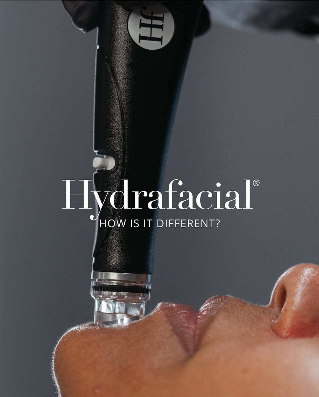 Instagram post by Dr. Jerry Darm: Not your average facial. 💁‍♀️�Hydrafacial uses patented vortex-fusion technology to cleanse, extract, and hydrate deeper for the most effec…