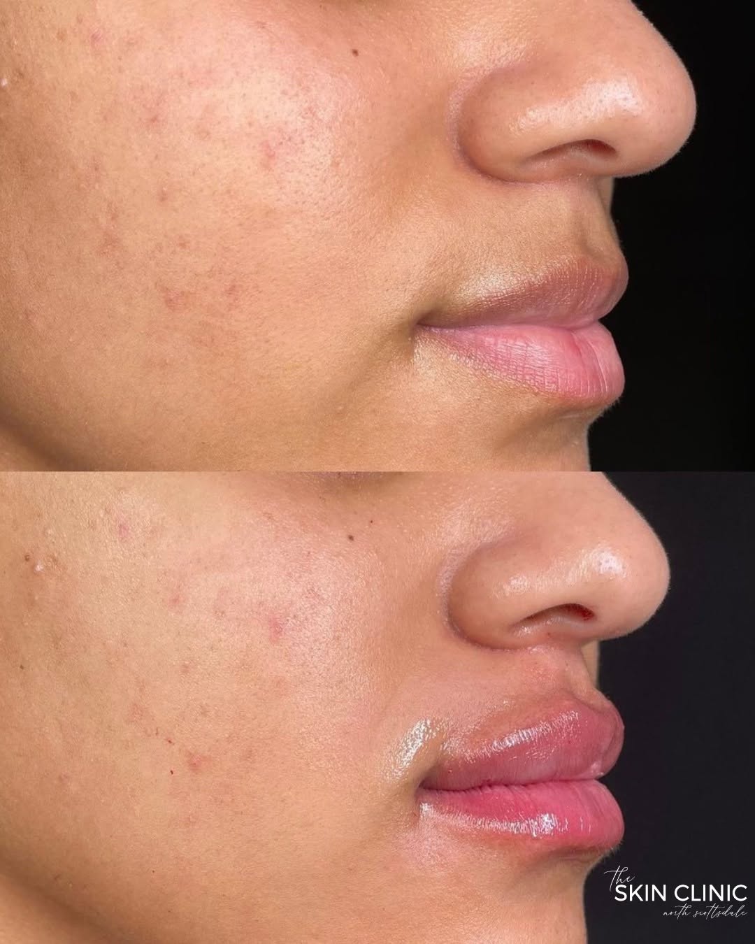 Instagram post by Dr. Jessica K. Anderson, N: If you can survive summer in Arizona, you can survive lip filler. 🌵🔥💋 Trust us, it’s worth the little pinch. 😉