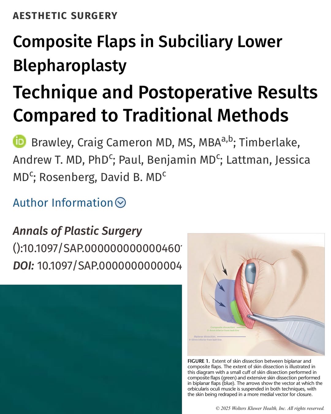 Instagram post by Dr. Jessica Lattman: Another peer-reviewed publication 📃 This paper is a complement to our last video publication on Composite Flaps in lower eyelid rejuvenatio…