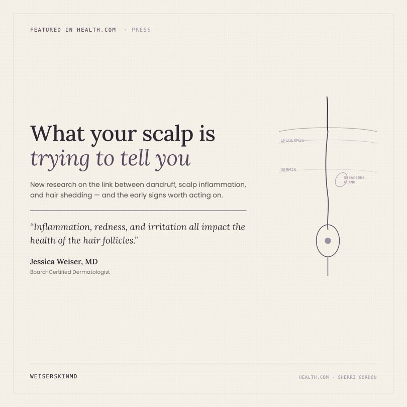 Instagram post by Dr. Jessica Weiser: Dr. Jessica Weiser was featured in @health discussing the connection between dandruff and hair loss - swipe for what to know and when to see…