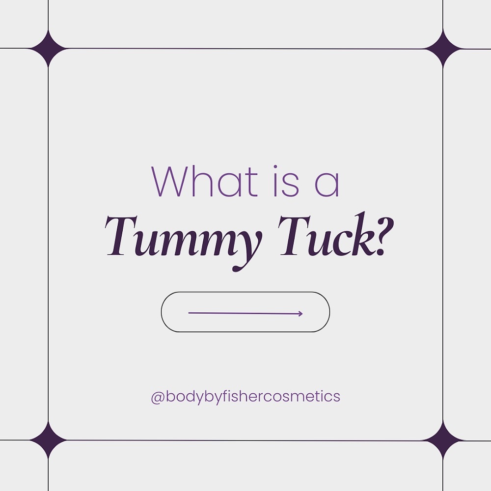 Instagram post by Dr. John Bradford Fisher: 🌟 What is a #tummytuck ? It’s a transformative procedure that corrects protruding or loose sagging abdominal skin. 💖 Perfect for those loo…