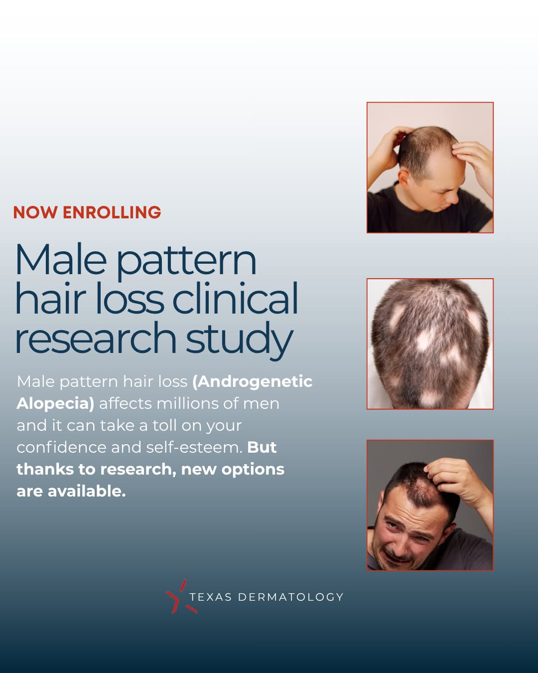 Instagram post by Dr. John C. Browning: What if your hair loss journey could help move hair loss treatment forward for others, too? 🔬⁠ ⁠ Texas Dermatology is currently enrolling p…