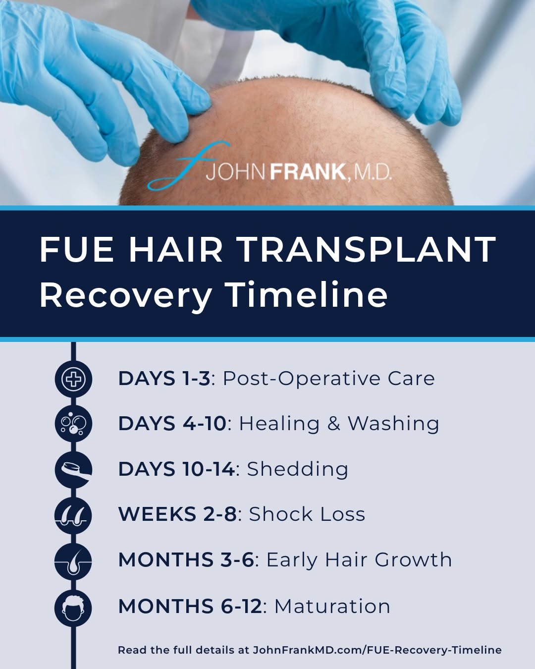 Instagram post by Dr. John E. Frank: Considering a hair transplant, but not sure what to expect after surgery? #FUEhairtransplant recovery is a process, but every step is a norm…