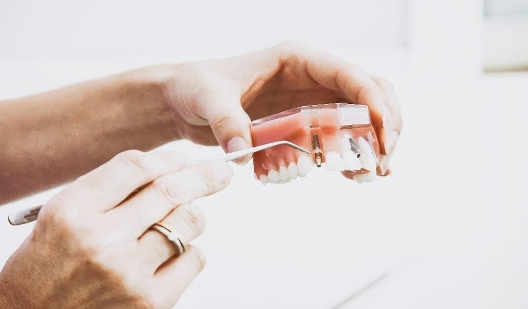 Instagram post by Dr. John Freeman: Did you know tooth implants are made of titanium or zirconia? The body accepts both as strong foundation replacements.