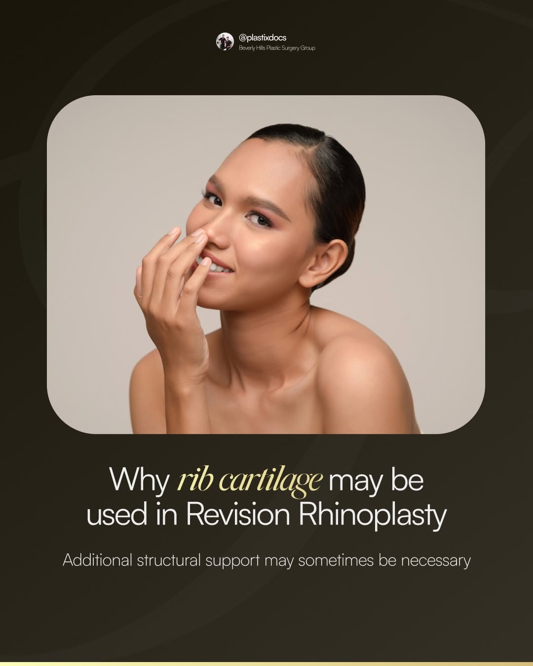 Instagram post by Dr. John Layke, DO: Structural support can become an important consideration when we plan a Revision Rhinoplasty. Previous surgery has already changed the nose,…